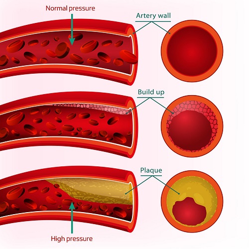 Blood Circulation: